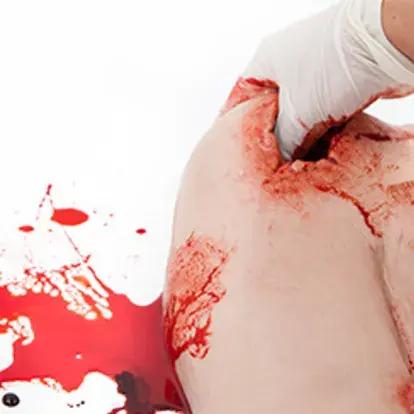 Simulación de heridas en hombro